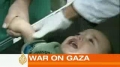 Children suffer in Israels war on Gaza - English